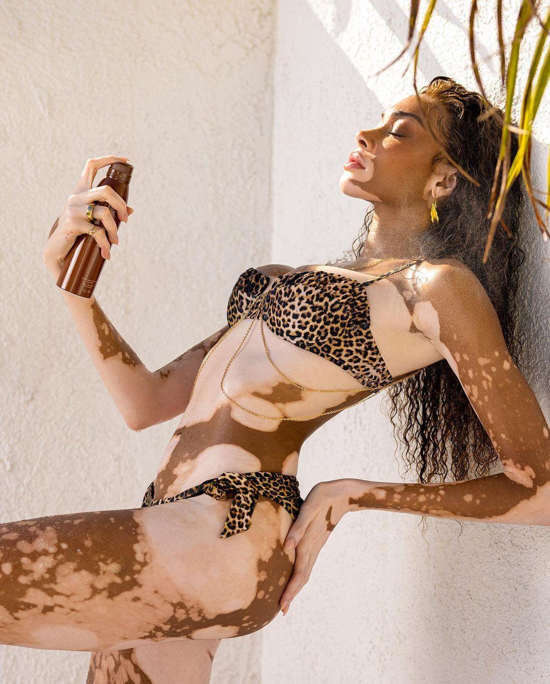  Φωτογραφία: Winnie Harlow/instagram 