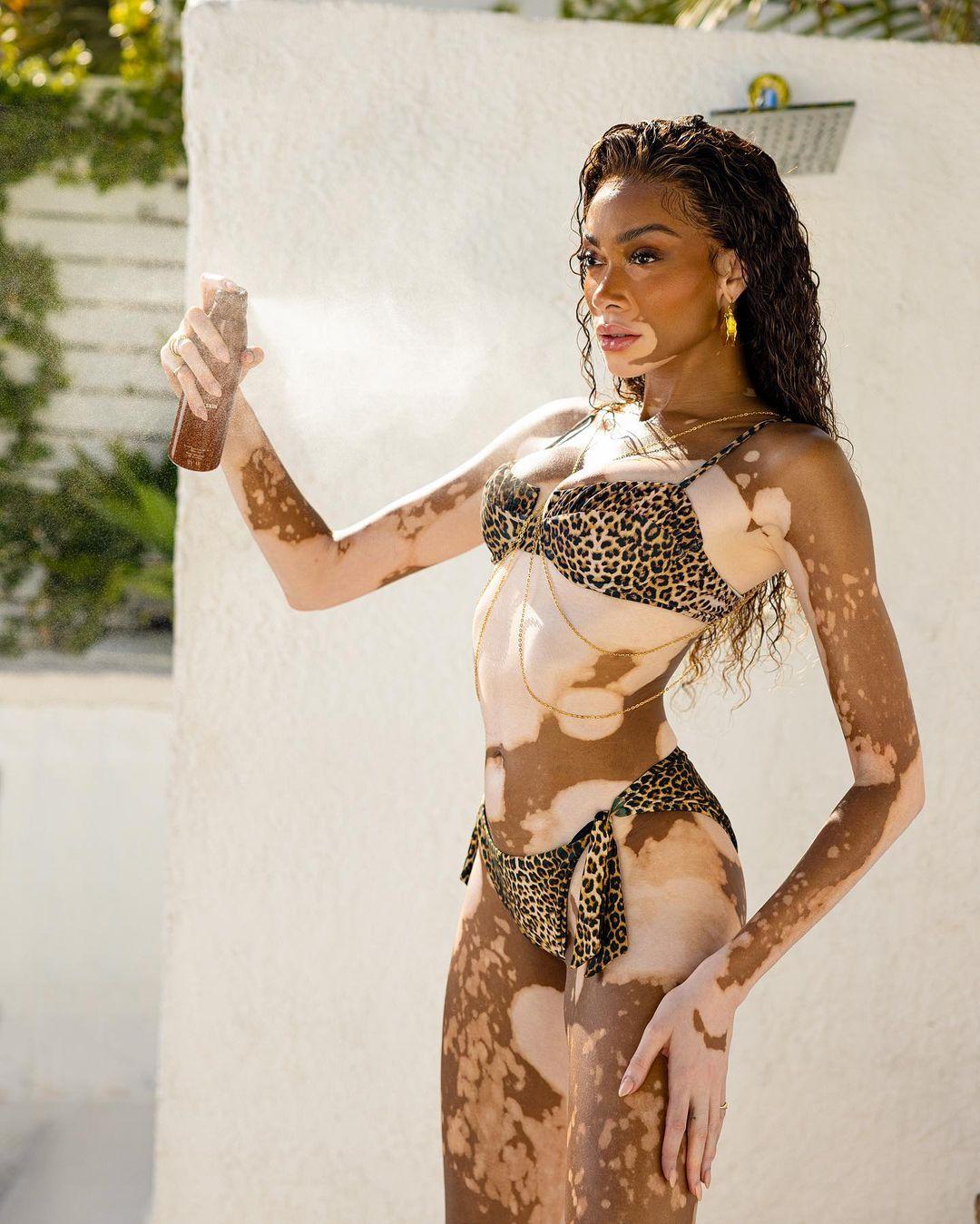 Φωτογραφία: Winnie Harlow/instagram