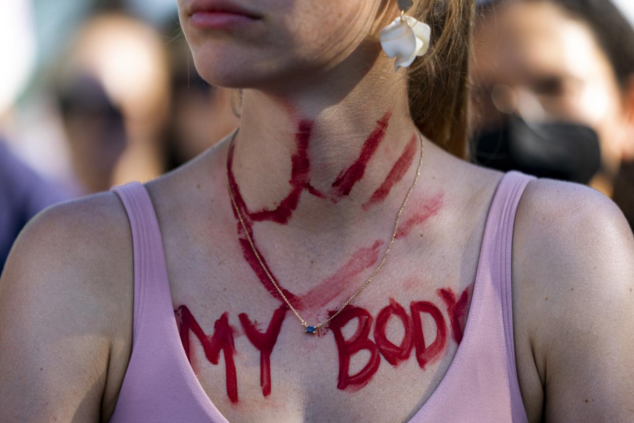 Φωτογραφία: AP Images