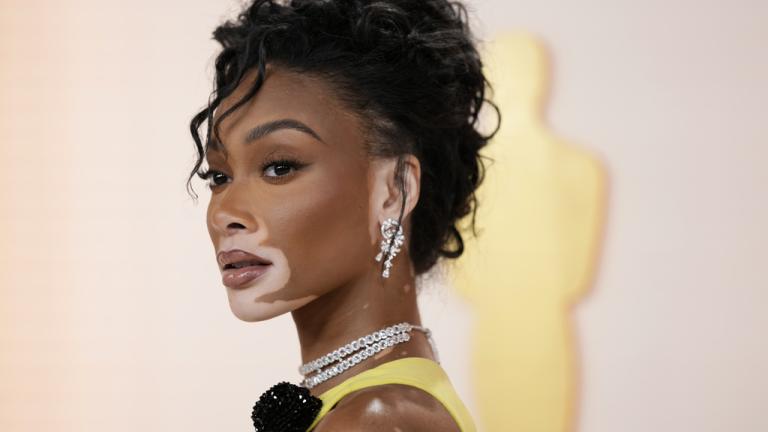 Oscar 2023, Winnie Harlow