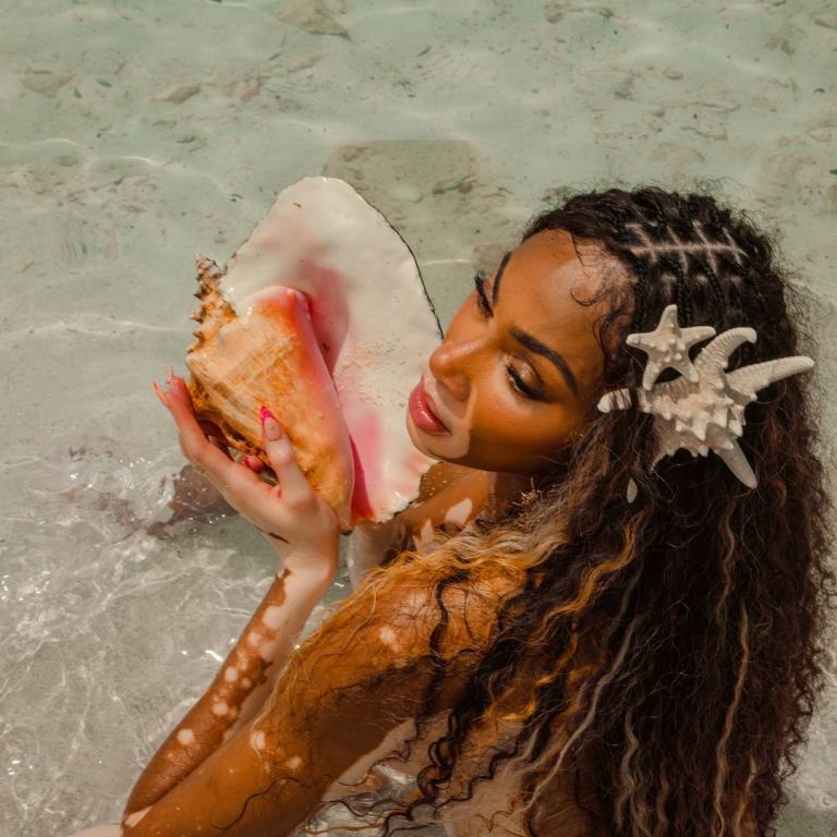 Φωτογραφία: instagram/@winnieharlow